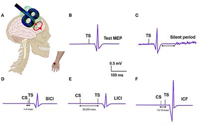 Transcranial Magnetic Stimulation in Tremor Syndromes: Pathophysiologic Insights and Therapeutic Role